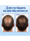 Раствор с миноксидилом 5% BosleyMD MAN Extra Strength Topical Solution для восстановления роста волос у мужчин Экстра Сила, 60 мл